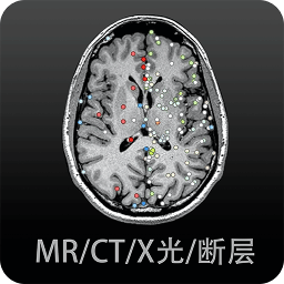 影像解剖图谱免费版