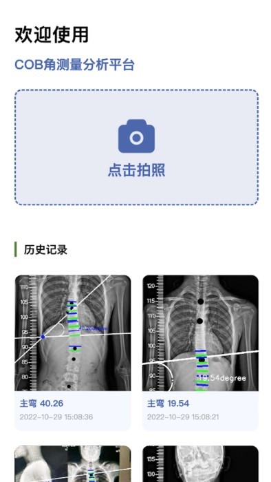 cobb角测量分析平台软件下载